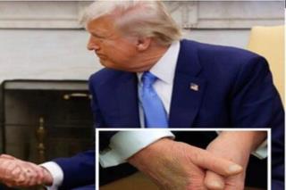 گمانه‌زنی‌های گسترده درباره بیماری و احتمال مرگ ترامپ
